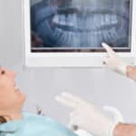 dental x-rays